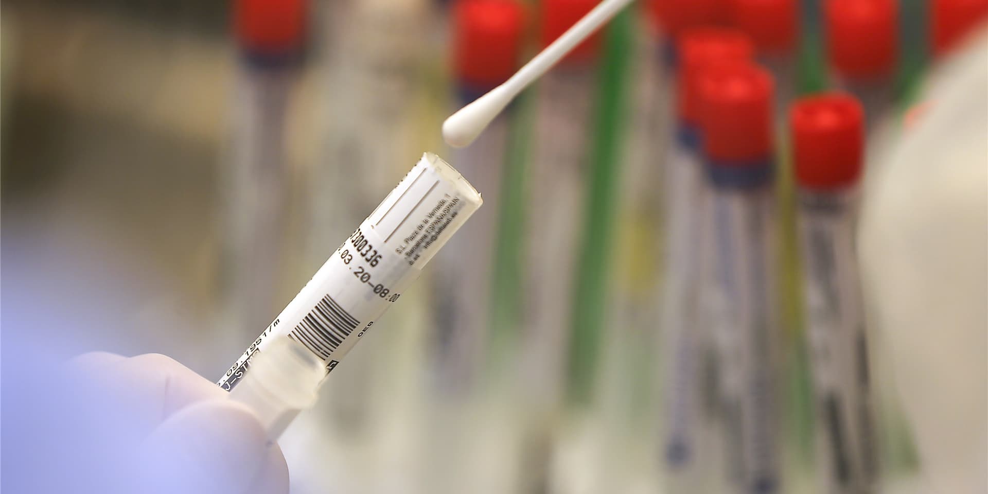 Wissenschaftler des Max-Planck-Instituts stellen ein neues Ergebnis vor: Ein von Neandertalern vererbter Erbgutabschnitt könnte das Risiko für einen schweren Krankheitsverlauf von COVID-19 erhöhen. (Symbolbild)