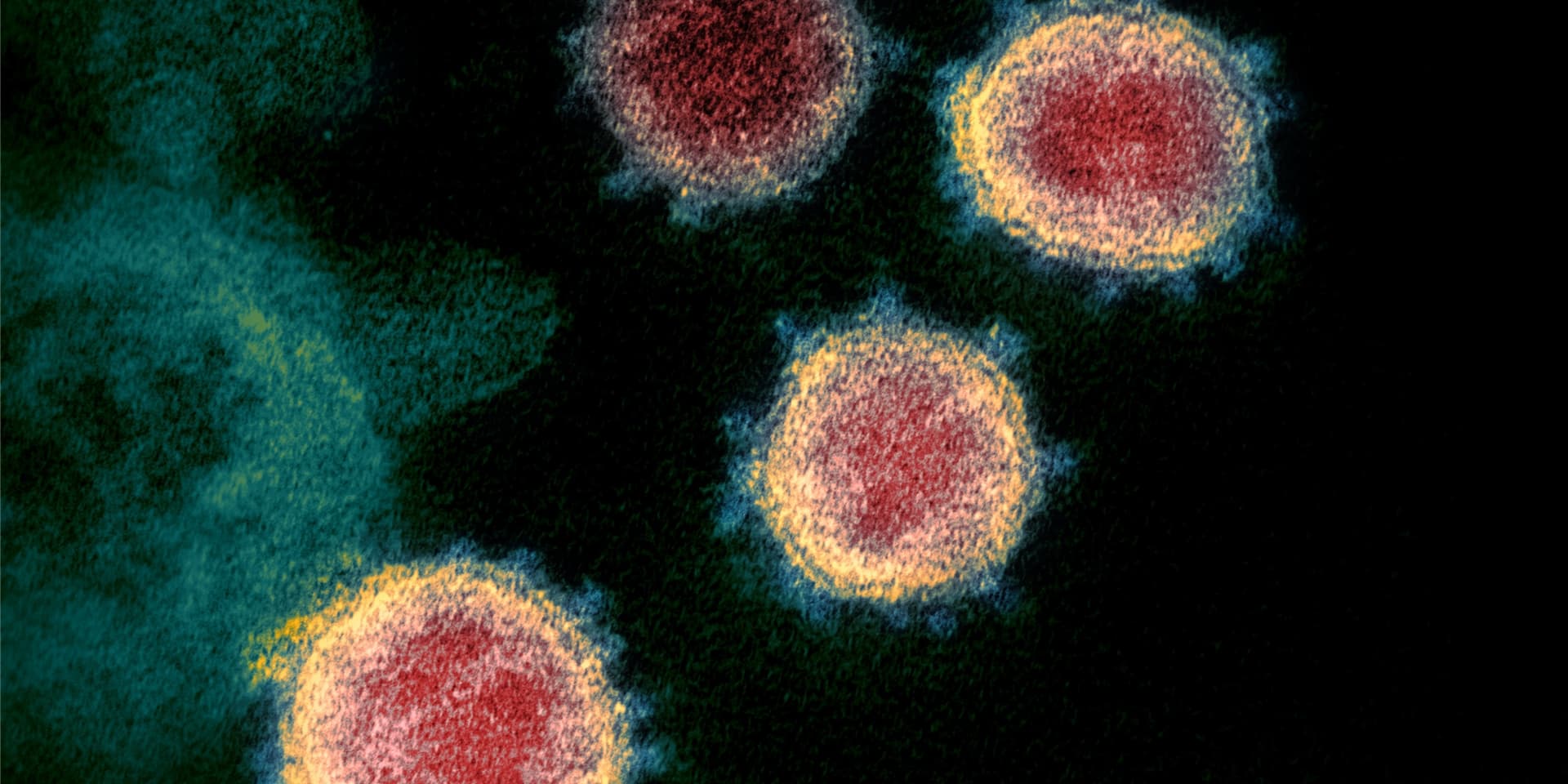 In Hinblick auf das Coronavirus Sars-CoV-2 gibt es noch einige Unklarheiten.