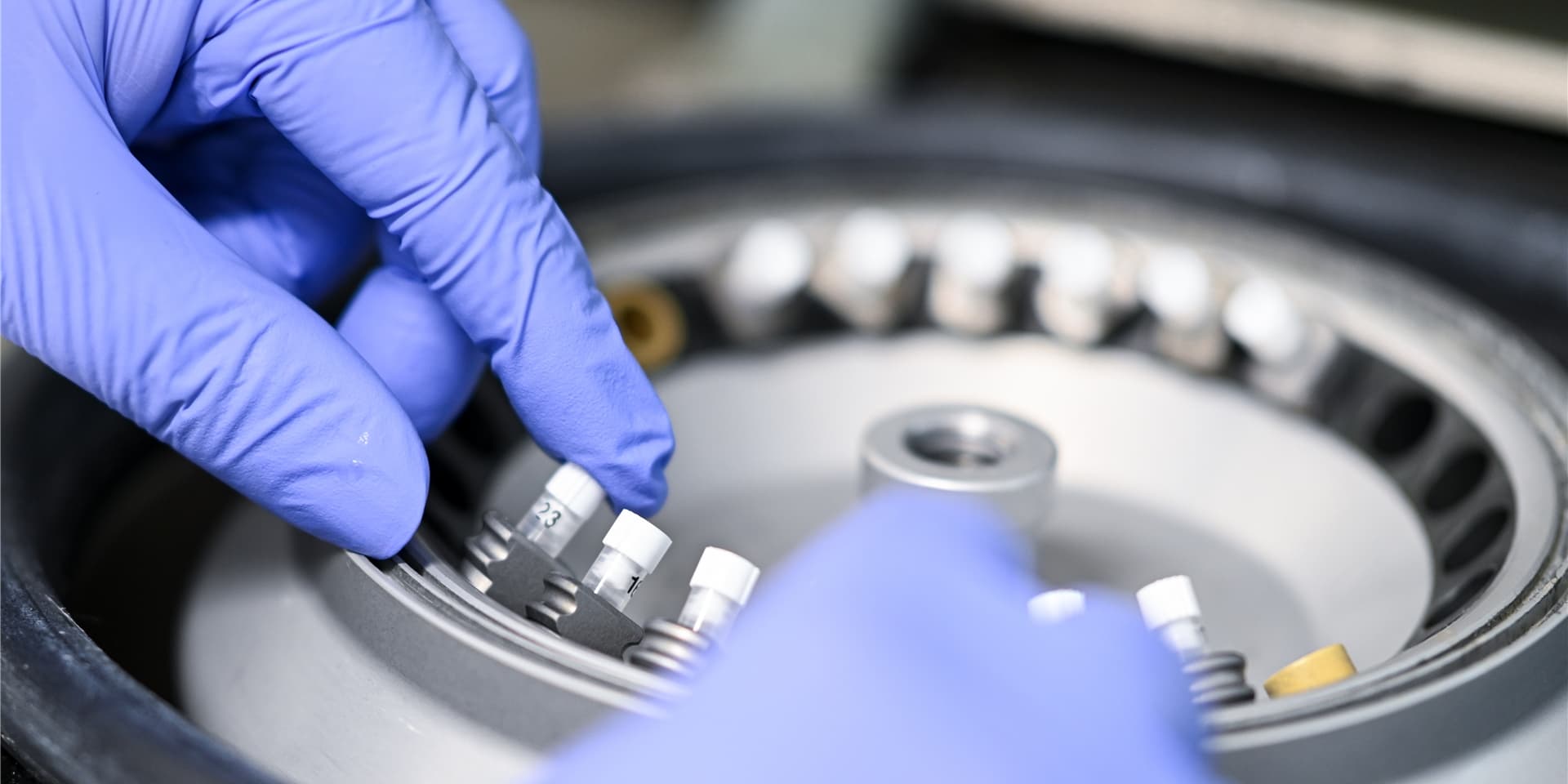 Die Labore in Deutschland sind durch die Auswertung der vielen Corona-Tests überlastet.