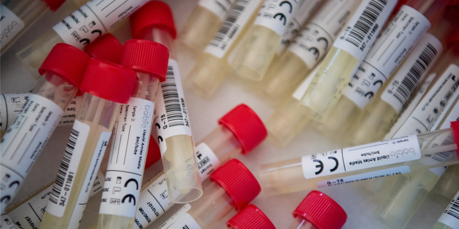 Die Stadt Dortmund vermeldet am Freitag 24 Neuinfektionen mit dem Coronavirus. (Symbolbild)