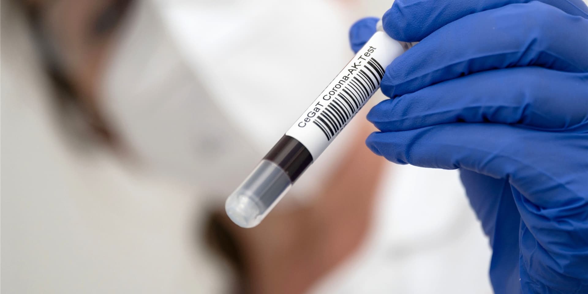 Wer im September im Klinikum Dortmund Blut gespendet hat, konnte sich kostenlos auf Corona-Antikörper testen lassen. (Symbolbild)