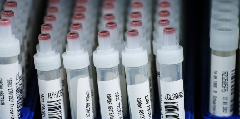 Viele positive Tests: In Dortmund steigen die Zahlen.