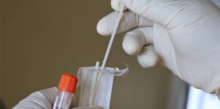 7 Personen in Werne wurden an vier Schnelltestzentren in der vergangenen Woche positiv auf das Coronavirus getestet.