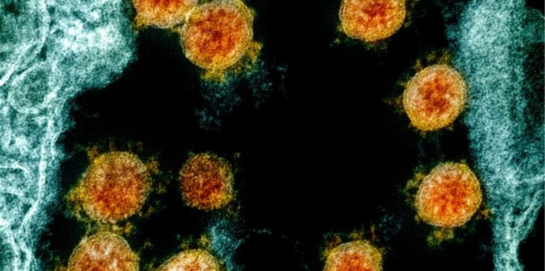 Diese elektronenmikroskopische Aufnahme aus dem Jahr 2020 wurde farblich bearbeitet und zeigt Partikel des Coronavirus SARS-CoV-2. Foto: Uncredited/NIAID/NIH/dpa
