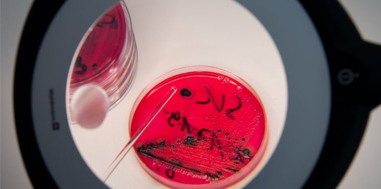 In der Landesuntersuchungsanstalt für das Gesundheits- und Veterinärwesen Sachsen (LUA) werden Salmonellen in einer Petrischale gezeigt.
