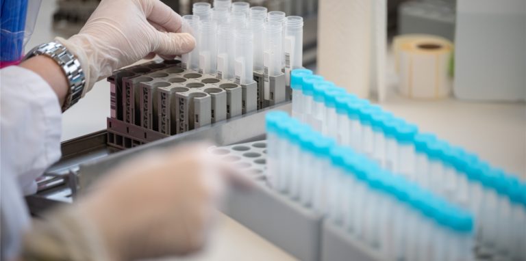 Eine Mitarbeiterin bereitet in einem Labor Teströhrchen für einen PCR-Test vor (Archivbild).