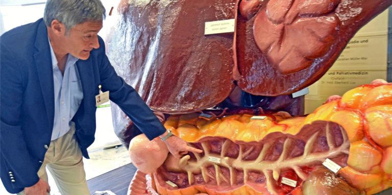 Dr. Roland Kurdow, Leiter der Chirurgie des Lüner Marienhospitals erklärt, warum die Anzahl der Darmkrebspatienten abnimmt.