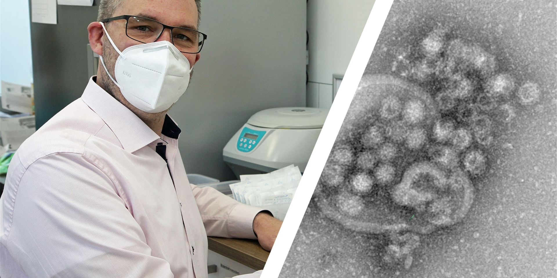 Die Anzahl der Infektionen durch das Norovirus hat sich diesen Winter vervierfacht. „Kein Grund zur Sorge“, meint Ärztesprecher Dr. Arne Krüger.