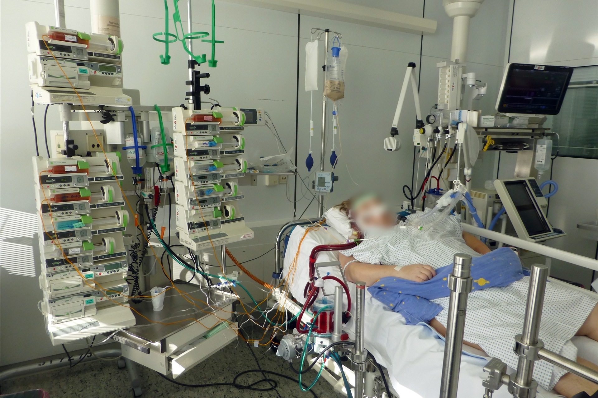 Sabine Weiß (Name geändert) ist in einer Universitätsklinik an ein Ecmo-Gerät angeschlossen. Sie überlebte die Therapie, Experten sind aber alarmiert wegen der Sterberaten.