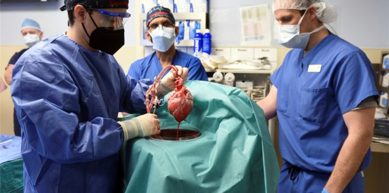 Auf diesem von der University of Maryland School of Medicine zur Verfügung gestellten Foto zeigen Mitglieder des Operationsteams ein Schweineherz, bevor es einem Patienten in Baltimore transplantiert wird.