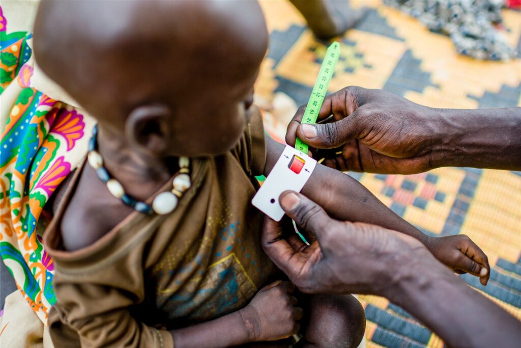 Ein unterernährtes Kind wird im Südsudan behandelt. Spulspeisung im Sudan ist eins der Projekte, in die die Spenden fließen sollen. Ein unterernährtes Kind wird im Südsudan behandelt. Spulspeisung im Sudan ist eins der Projekte, in die die Spenden fließen sollen.