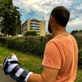 Bei einem Angriff ist ein 29-jähriger Dortmunder Anfang August schwer mit einer Machete verletzt an der Hand worden. Er hat außerdem eine Wunde am Hals.
