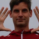 Fabian Panne zeigt seine Hände.