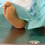 Ein Verstorbener liegt in einer Pathologie.