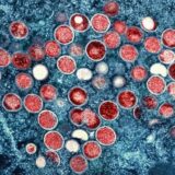 Eine eingefärbte Mikroskopaufnahme von Mpox-Partikeln (rot) in einer infizierten Zelle (blau), die im Labor kultiviert wurde.